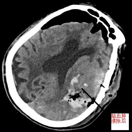 20230306103114_65081.jpg 20230306103114_65081.jpg