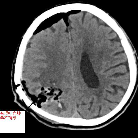 20231110150540_10851.jpg 20231110150540_10851.jpg