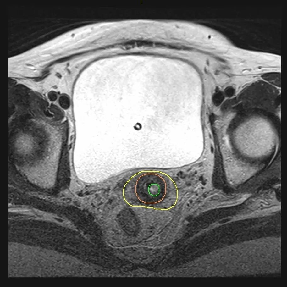 20231208163423_83676.jpg 20231208163423_83676.jpg