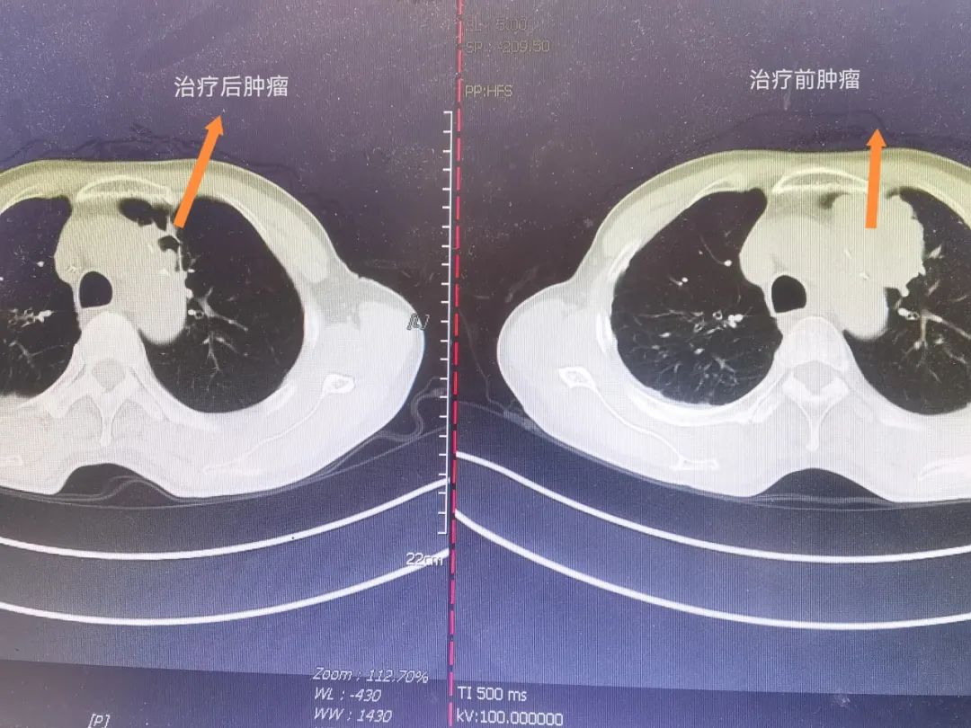 20240204095151_75301.jpg 20240204095151_75301.jpg