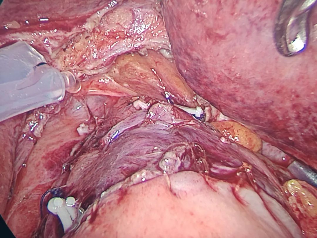 20240701111541_82398.jpg 20240701111541_82398.jpg