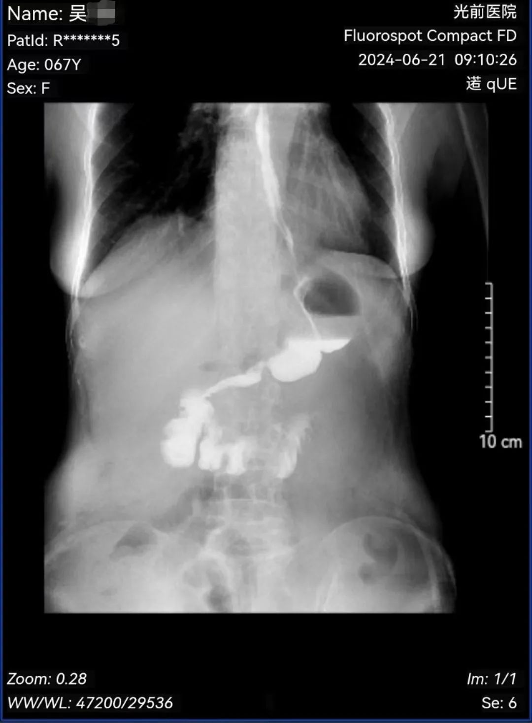 20240701111541_94743.jpg 20240701111541_94743.jpg