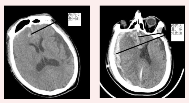 1674873629822722.png 微信圖片_20230128104014.png